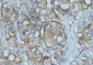 Goat Anti-NDRG1 Antibody